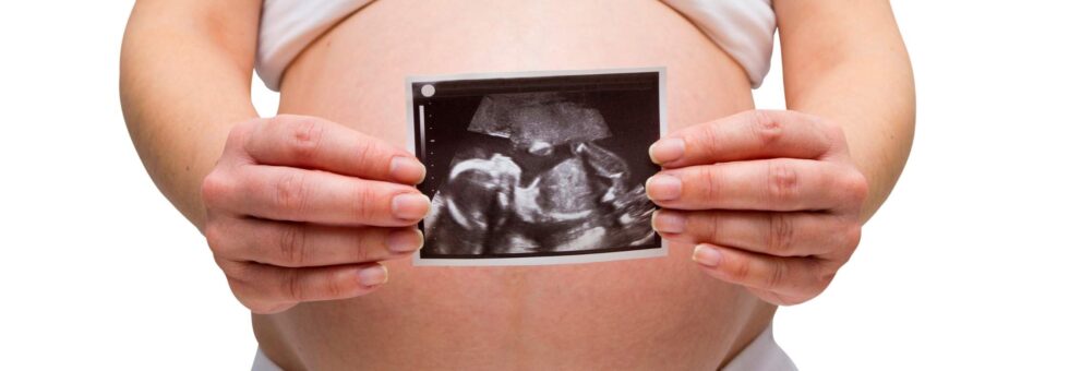 Smoking marijuana while pregnant: A pregnant lady holding an image of the ultrasound.